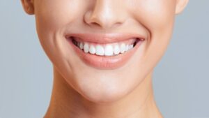 Cosmetic Dentistry in Gurgaon: Braces, Whitening, and Tooth-Colored Fillings