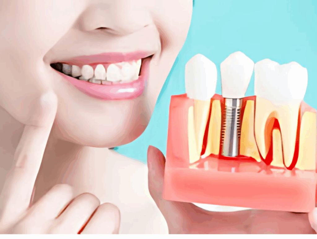 Dental Implants: The Top 5 Life-Changing Benefits You Will Notice